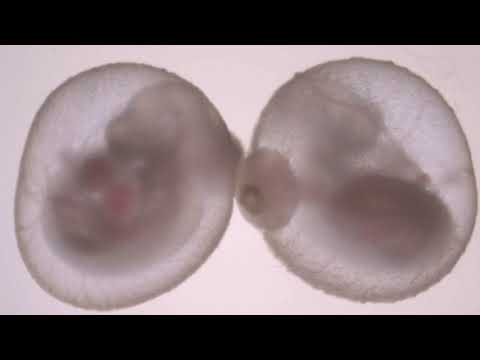 Advanced embryo growth outside a uterus